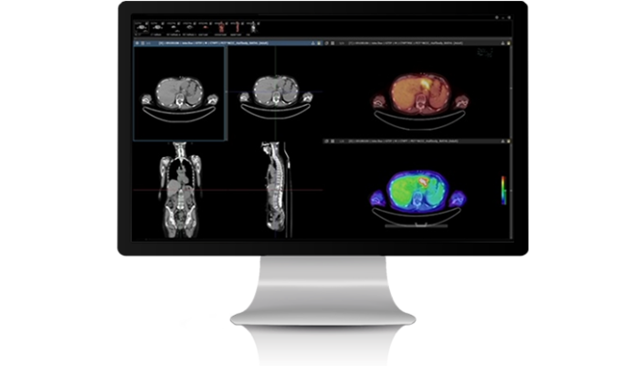 Radiologiczny System Pacs Infinitt Infinitteurope