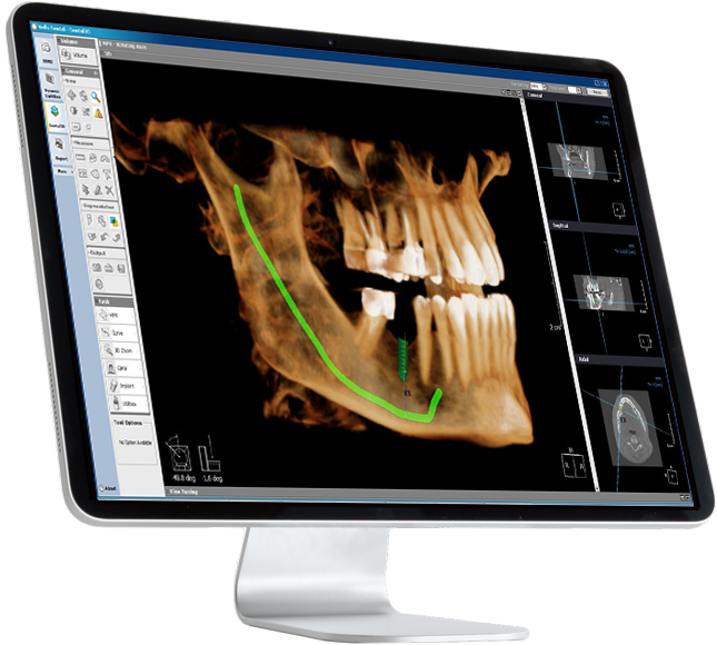 Dental PACS